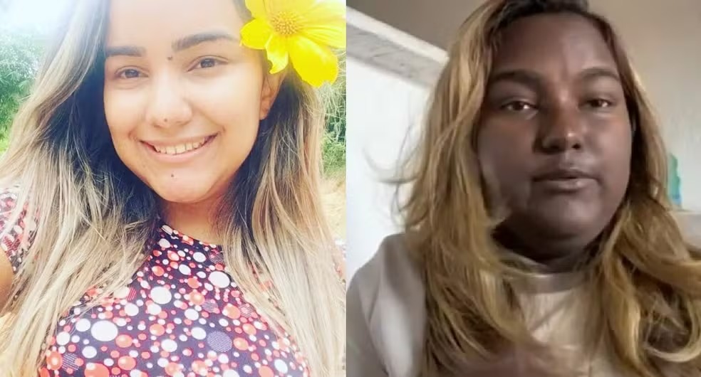 Jovem com tumor raro que levou à mudança de cor da pele teve que abandonar estudos por causa da doença