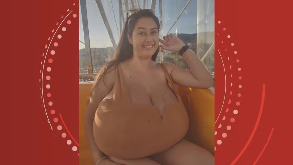 Estudante com gigantomastia faz cirurgia e retira 10 kg de mama no Paraná: 'Não estava mais aguentando'